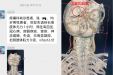 九旬退役老兵突发脑梗，医生妙术取出致命血栓