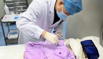 肿瘤淋巴软组织儿童科为 “3月龄婴儿”实施肝组织穿刺活检