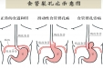 食不断药二三载，一朝修补解忧愁