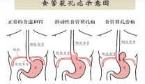 食不断药二三载，一朝修补解忧愁