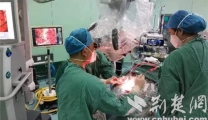 【荆楚网】脑血管搭桥 治疗“烟雾病”