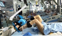 【健康科普】床旁下肢主被动运动训练系统，卧床患者的康复助手