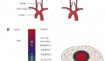 【MCAO】大鼠四血管闭塞法建立全脑缺血性脑卒中动物模型