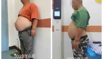 肥胖也是病，减重要科学