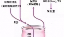 【健康科普】如何解读胆红素结果？