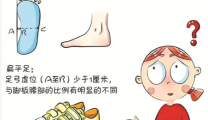 《襄阳晚报》孩子经常脚疼      当心是扁平足