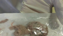 儿童噎食命悬一线，急诊医护争分夺秒施救