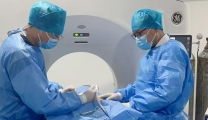 莫让肺结节成心结  冷冻消融 “针孔”微创来治疗