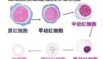 血液性疾病别忽视这个指标——网织红细胞
