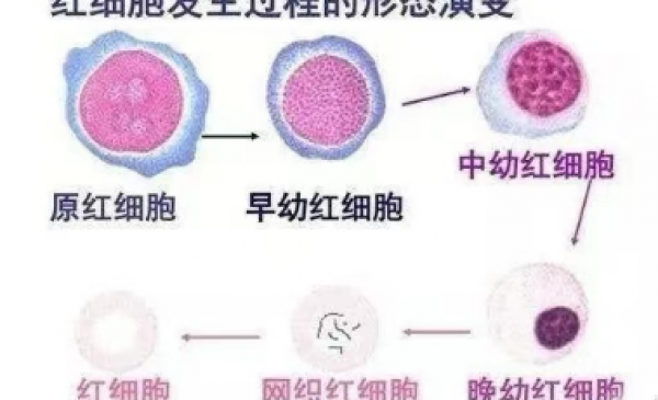 血液性疾病别忽视这个指标——网织红细胞