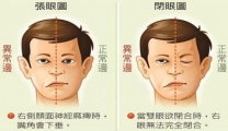 春风拂面令人爱，“面瘫”来袭当提防