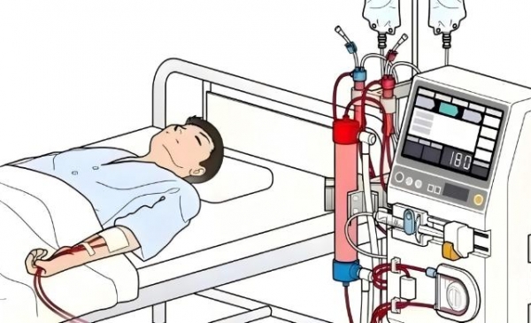 血管通路“黑科技”，捍卫血透“生命线”